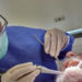 Acude al dentista y termina con una pieza de taladro en el pulmón