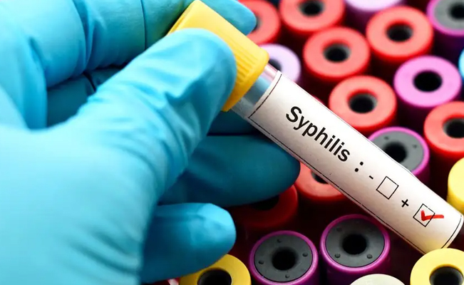 OPS alerta por aumento de casos de sífilis y sífilis congénita en América