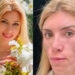 Ex reina de belleza rusa se somete a cirugía estética y termina desfigurada