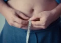 Biopolímeros en Labios: Riesgos y Recomendaciones para su Remoción